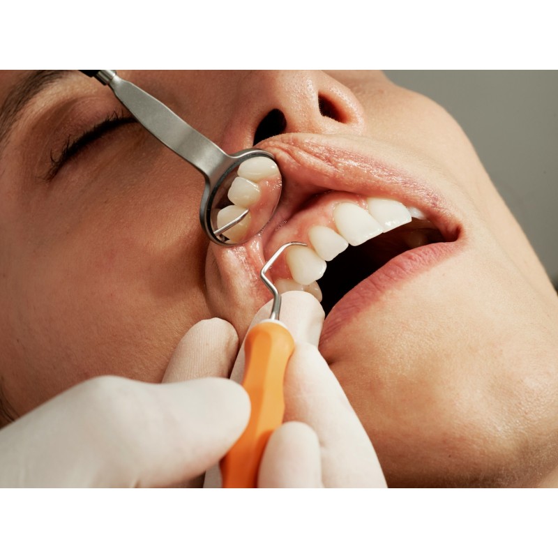 Detartraj și Periaj Profesional